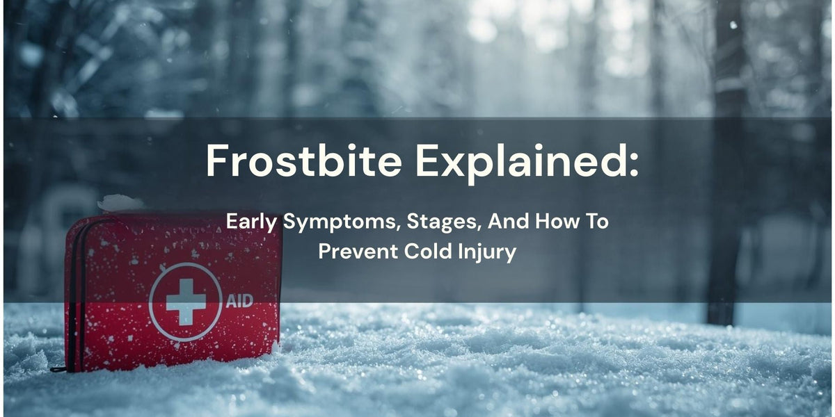 Frostbite Explained: Early Symptoms, Stages, And How To Prevent Cold ...